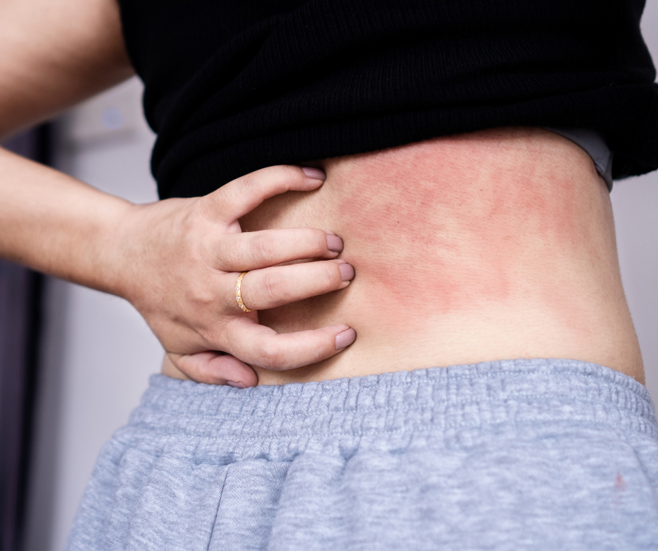 glutathione lyme disease Antioxidant Therapy Glutathione in Lyme Disease -